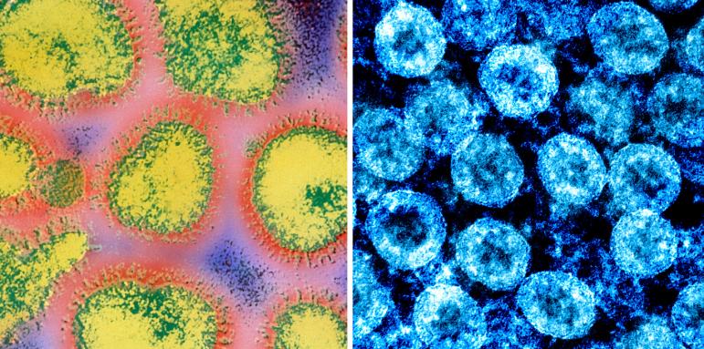 РЗИ пусна плашеща информация за смърт от грип