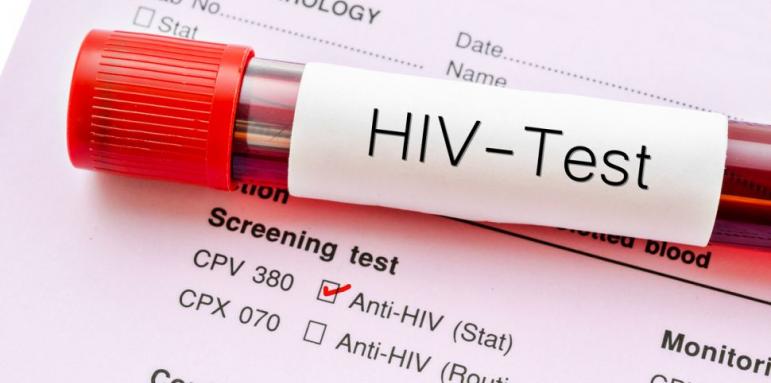Сензация: Жена пребори ХИВ без лечение
