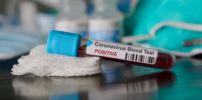 Първа жертва на коронавируса в Европа